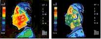 Thermographic image display of head heating by Cellphone and reduction of this by GIA Cell Guard